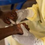 Le Cameroun en alerte maximale contre le Mpox